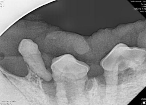 Digital Dental Radiograph
